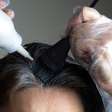 O que fazer em caso de alergia à tinta de cabelo?