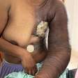 A Luta de Nilceia Contra o Câncer de Mama: Uma Mãe em Busca de Ajuda