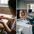 Tricobezoar: menina de 7 anos comia cabelo desde os 2 e tinha massa de 12 cm no estômago. Retirada levou 15 horas