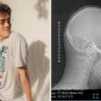 Músico ficará acordado durante cirurgia de 6 horas para retirar tumor do cérebro
