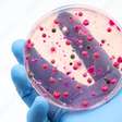 Micotoxinas: pesquisa mundial alerta para riscos na qualidade dos grãos