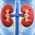 Cálculo renal: Conheça 5 alimentos que são prejudiciais aos rins