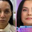 Aos 55 anos, Mônica Carvalho faz harmonização facial e mostra antes e depois