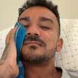 Danilo, do Flamengo, publica foto com pinos de cirurgia no rosto