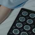 AVC: sintomas, prevenção e a importância do atendimento rápido