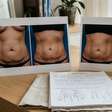 Por que a mesma cirurgia plástica pode ter resultados tão diferentes em cada pessoa