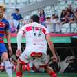 Fortaleza tem local de jogo alterado pela CBF; entenda