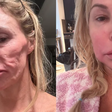 Estrela de reality show revela que vai 'tirar o rosto fora' para investigar suposto parasita
