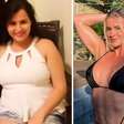 Após perder 20 kg, influencer mostra transformação e admite ter 'canetafobia'