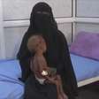 ONU: Iêmen corre risco de viver crise de fome por conflito