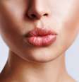 Proteja a boca durante o ano todo e fazer da hidratação labial um hábito. O calor e o frio deixam os lábios ressecados com tendência a fissuras e descamação, e pode, inclusive, desencadear o aparecimento de herpes labial. Para cuidar da sua boca, veja algumas dicas que a dermatologista Vanessa Metz, da Academia Americana de Dermatologia -AAD-, ensina.   Foto: Shutterstock