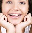Para o tratamento com aparelho ortodôntico ser um sucesso, é preciso ter atenção redobrada com a higiene bucal. Isso porque a escova e o fio dental encontrarão mais obstáculos na boca, como braquetes, fios e bandas.   Foto: Shutterstock