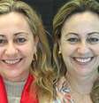 Marli Cecília Lopes Walendowsky é paciente de Joel e ficou muito satisfeita com o resultado do tratamento.  Foto: Shutterstock