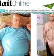 <p>Stephen Dockerill perdeu 82 kg com uma cirugia bariátrica, mas agora sofre com o excesso de pele de sua barriga</p>  Foto: Reprodução