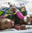 As gêmeas siamesas  A'zhari (de rosa) e A'zhiah Jones (de azul) foram fotografadas antes de passar pela última etapa da cirurgia de separação  Foto: Daily Mail / Reprodução