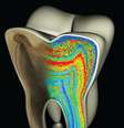 Modelo de dente molar mostra padrões acentuados para refletir presença de bário: amostras revelam que homem-de-neandertal teve desmame precoce, quando comparado aos humanos modernos  Foto: Ian Harrowell, Christine Austin e Manish Arora / Divulgação