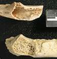 Comparação entre o osso anormal de um neandertal (acima) e o de uma amostra normal (abaixo)  Foto:  PLOS One / Divulgação