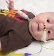 <p>Beb&ecirc; sofre com s&iacute;ndrome que afeta 500 pessoas no planeta</p>  Foto: Reprodução