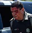 <p>Oito policiais ficaram feridos durante confronto com manifestantes em Fortaleza</p>  Foto: AFP