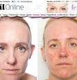 <p>Repórter fica um mês sem tirar a maquiagem e percebe efeitos negativos na pele</p>  Foto: Reprodução