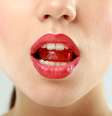 Balas, chicletes e enxaguatórios para disfarçar o mau hálito só inibem o odor não e mascaram problemas bucais  Foto: Shutterstock