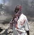 Homem ferido é fotografado após atentado terroristas reivindicado pela Al-Shabab em Mogadíscio, em 4 de outubro de 2011  Foto: AP