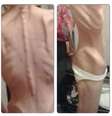 <p>Aos 34 anos, mulher chegou a pesar 24 kg</p>  Foto: Arquivo Pessoal