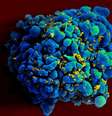 Imagem de microscópio eletrônico mostra célula T H9, em azul, infectada com HIV, amarelo  Foto: AP