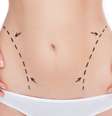 Insatisfeitas com mais de uma característica do corpo, mulheres procuram associar procedimentos cirúrgicos para promover uma transformação completa do visual  Foto: Shutterstock