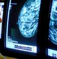 Entidades que combatem câncer de mama não recomendam uso de estatina e pedem mais estudos  Foto: BBC News Brasil