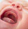 Para detectar o problema mais cedo, é indicado o teste da linguinha que é simples e indolor. O profissional eleva a língua do bebê e checa se o tamanho e posição do frênulo estão adequados  Foto: Shutterstock