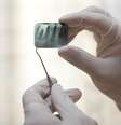 O tratamento de canal oferece mais de 95% de chance de salvar o dente. Para atingir esse índice, é preciso conhecer a anatomia, a fisiologia nervosa e os processos inflamatórios  Foto: Shutterstock