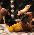 <p>Anderson Silva sofreu fratura em luta contra Weidman</p>  Foto: Reuters
