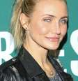 A atriz sofreu com acne e espinhas  Foto: Getty Images 
