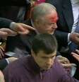 Um deputado ficou com o nariz sangrando depois de levar um soco no rosto de outro parlamentar  Foto: BBC News Brasil