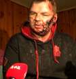 Dmytro Bulatov, que organizou protestos de rua na capital, Kiev, está hospitalizado após ter sido encontrado nos arredores da capital ucraniana  Foto: AFP