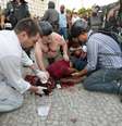 <p>Santiago Andrade ficou ferido depois de ser atingido por estilhaços de uma bomba</p>  Foto: Daniel Ramalho / Terra