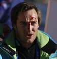 Esloveno Rok Perko lesionou o rosto após queda no ski alpino downhill  Foto: Reuters