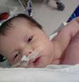<p>Sofia, 4 meses, precisa de uma cirurgia complexa, pois não consegue digerir alimentos</p>  Foto: Facebook / Reprodução