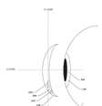 <p>Desenho da lente de contato inteligente do Google</p>  Foto: US Patent and Trademark Office / Reprodução