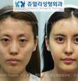 <p>Pacientes investem em transformação do rosto na Coreia do Sul</p>  Foto: Jewelry MedicalPs/Facebook / Reprodução