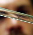 Vírus chikungunya pode ser transmitido pelo mosquito da dengue  Foto: AFP