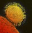 <p>Vírus causador da Síndrome Respiratória do Oriente Médio é visto em micrografia eletrônica do Instituto Nacional de Alergia e Doenças Infecciosas dos EUA</p>  Foto: Reuters
