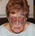 <p>Anne Heenan, de 74 anos, ficou gravemente ferida após tropeçar no meio-fio entre a rua e a calçada no centro de Grimsby, no Reino Unido</p>  Foto: Daily Mail / Reprodução