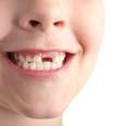 Alguns pais preferem deixar cair sozinho, mas às vezes o filho se mostra tão impaciente com a situação que, antes que acabe se machucando, é melhor intervir com métodos seguros  Foto: Shutterstock