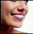 A grande vantagem do Invisalign é que os aparelhos são móveis e podem ser retirados para comer e escovar os dentes. São aparelhos altamente estéticos e uma alternativa quase invisível  Foto: Invisalign / Divulgação