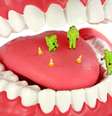 As bactérias bucais podem ser um problema quando conseguem acesso à corrente sanguínea, o que pode acontecer em pessoas com gengivite   Foto: Shutterstock