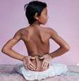 <p>Arshid Ali Khan, de 13 anos, terá que passar por uma cirurgia devido à anomalia. Ele não consegue andar</p>  Foto: Facebook / Reprodução