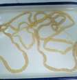 <p>O verme instalado no intestino da chinesa Li tinha 2 metros de comprimento</p>  Foto: Twitter