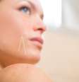 Além de tratar problemas como dores nas costas e ansiedade, a acupuntura também pode ser aplicada em prol da beleza feminina  Foto: Shutterstock